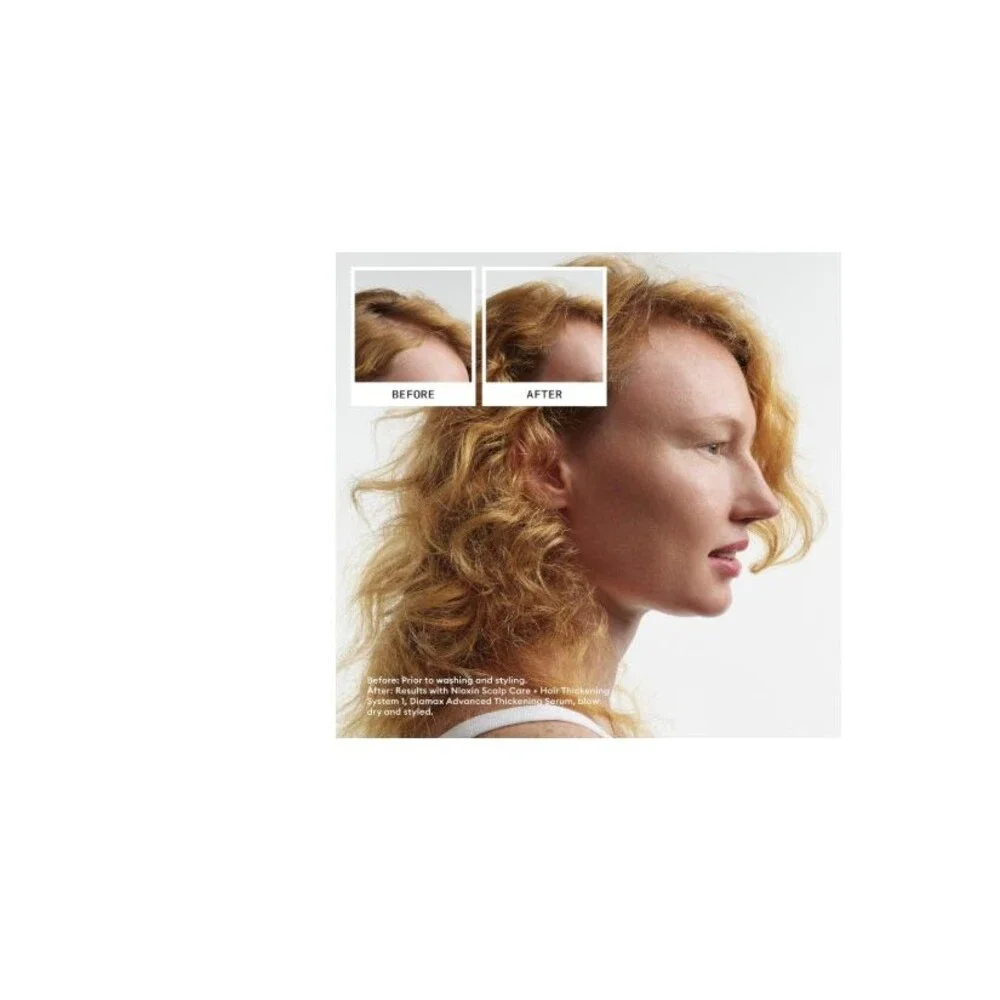 Nioxin System 1 Scalp + Hair Thickening Conditioner for Natural Hair 33.8 oz